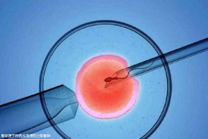 高齢初産